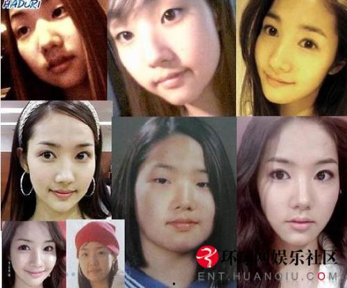 韩国整过容的女明星,揭秘整过容的女明星风采